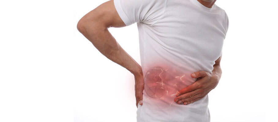 Kidney Stones (Nephrolithiasis) - Symptoms and Causes