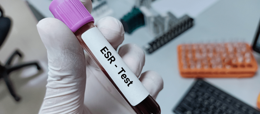 ESR Blood Test: Possible Reasons For High ESR Levels