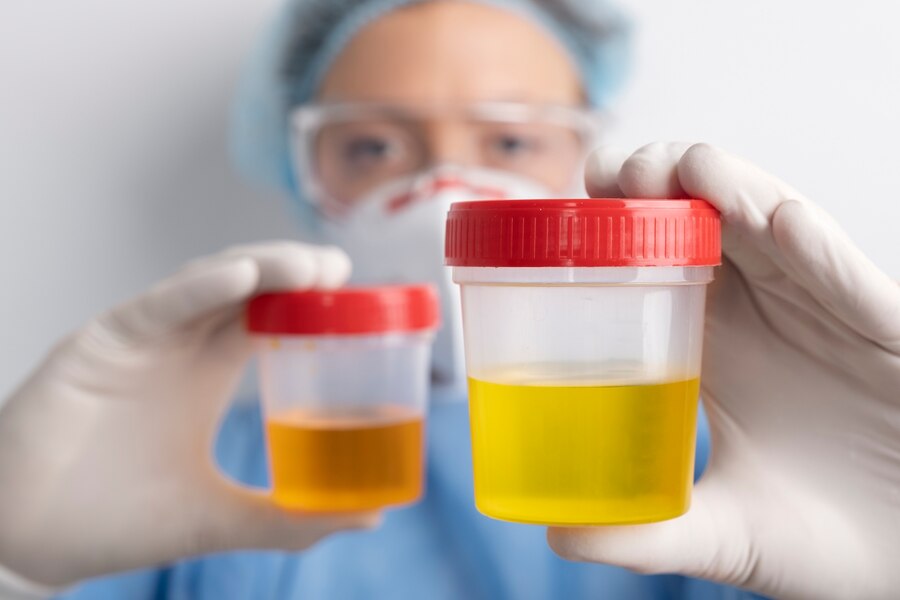 Why does Urine Color Change to Yellowish During Pregnancy?